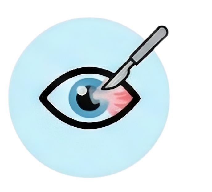 Pterygium Excision