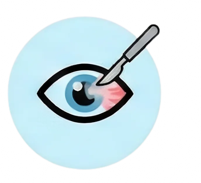 Pterygium Excision